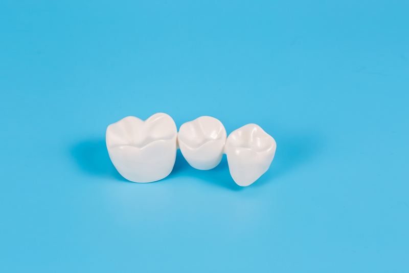 Understanding the Cost: How Much is One Crown Tooth?